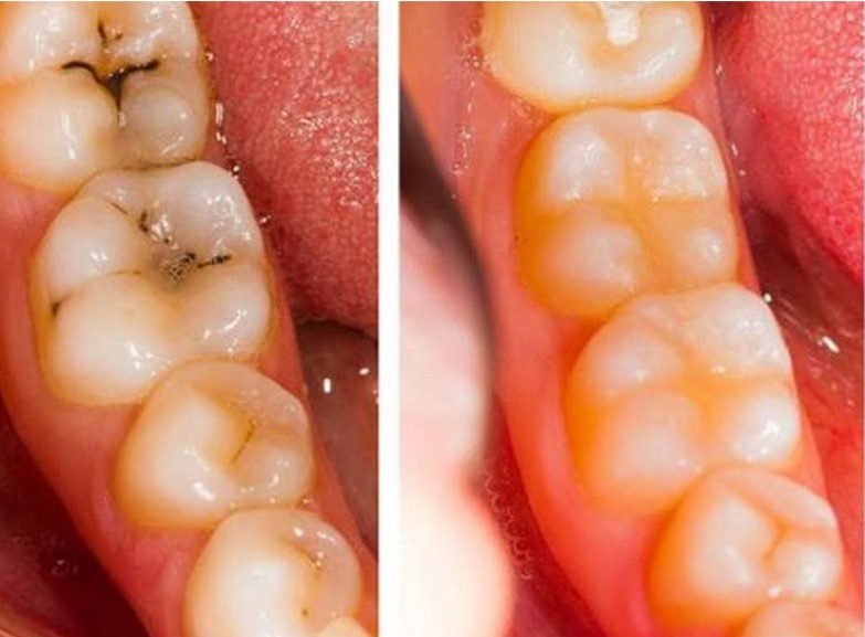 Assiette colorée avec des aliments bons pour les dents