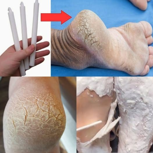 Une bougie allumée, symbole du soin maison pour les pieds