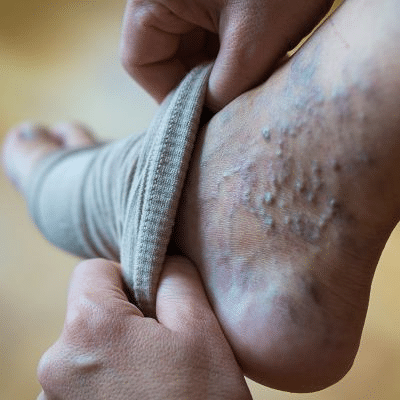 Personne faisant des exercices pour les jambes