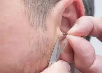 Détail de poils dans l'oreille