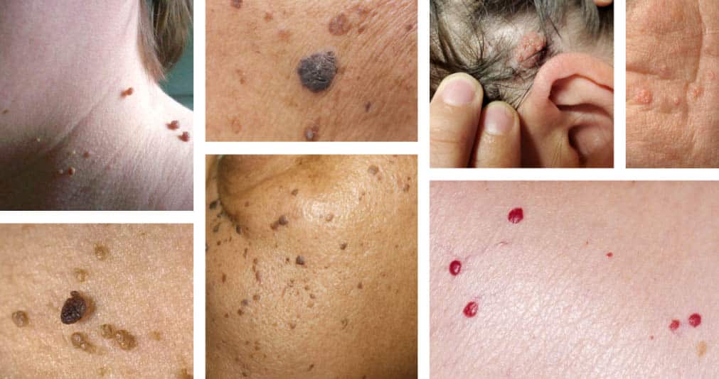 Solutions naturelles pour la peau