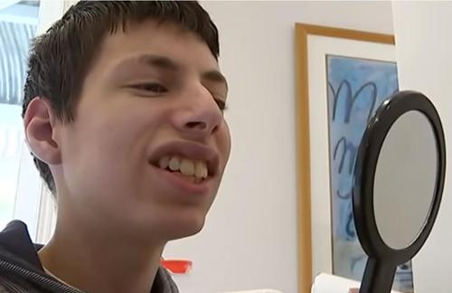 Evan Hill après son traitement avec un sourire radieux