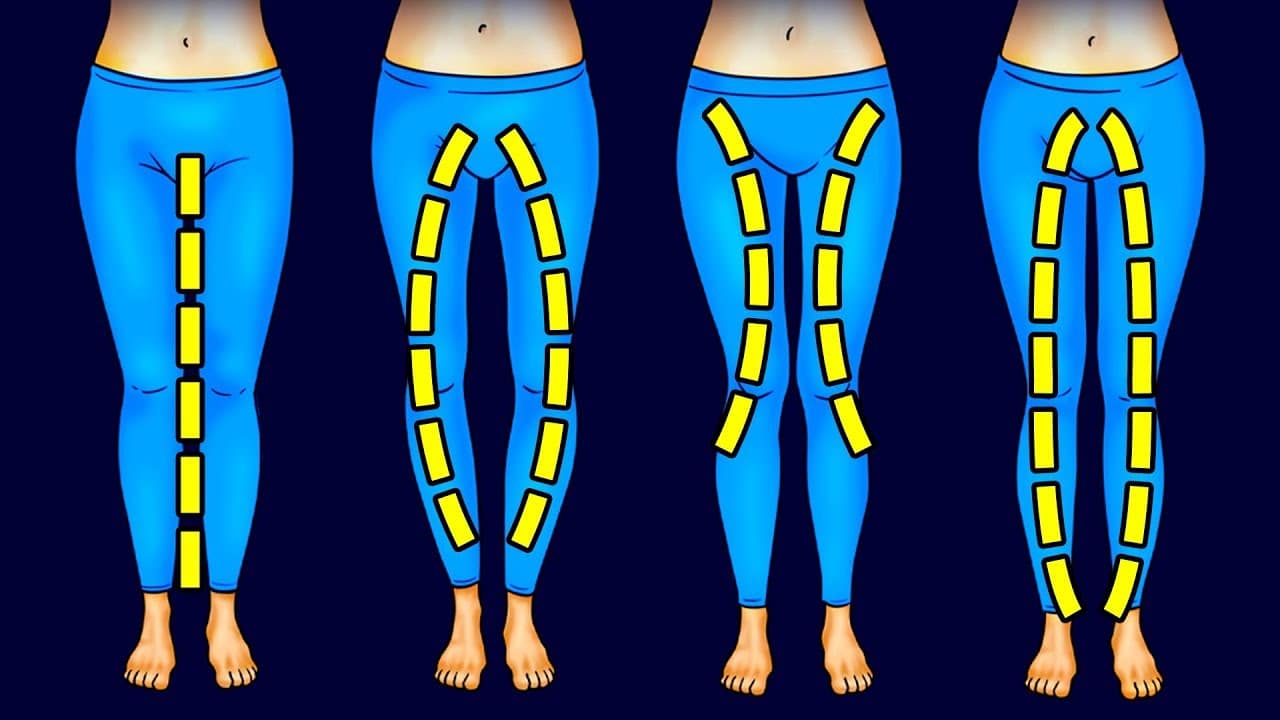 Différents types de morphologie des jambes