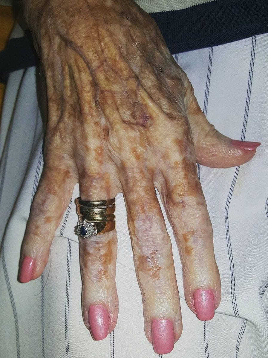 Main d'une personne âgée recevant des soins esthétiques