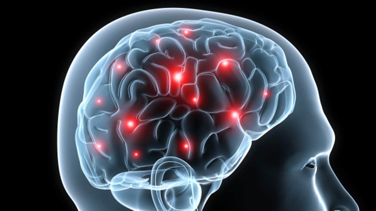 Zone du cerveau responsable des réactions involontaires